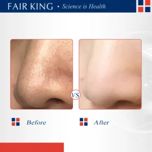 FAIR KING Green Tea Mask Blackhead Nose Oil Control Mask Deep Pore Cleansing Dirt and Blackhead Removal Skin Care Smooth 40g kf Sbbb28a5d4476418097463a08bc450cb6W