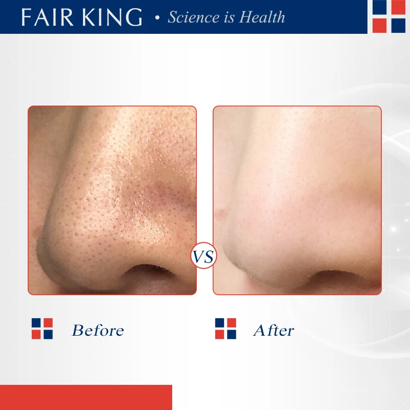 kf-Sbbb28a5d4476418097463a08bc450cb6W kf Sbbb28a5d4476418097463a08bc450cb6W